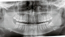 KaVo 3D CBCT rentgen OP 3D Pro