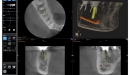 Carestream 3D CBCT rentgen CS 9000