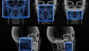 Carestream 3D CBCT rentgen CS 9300 Select / Premium