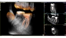 Acteon 3D CBCT rentgen X-MIND Trium 3D CEPH