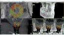 Acteon 3D CBCT rentgen X-MIND Trium 3D CEPH LOW DOSE