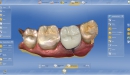 Dentsply Sirona CAD/CAM ordinační software CEREC SW