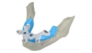 Dental Wings CAD/CAM ordinační software CoDiagnostiX