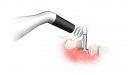 Integration Diagnostics PenguinRFA přístroj pro měření stability implantátů