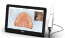 Align Technology intraorální skener iTero Lumina
