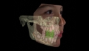 KaVo 3D CBCT rentgen OP 3D Vision