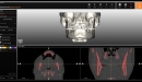 Zirkonzahn CAD/CAM Milling Implant-Planner