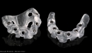 Zirkonzahn CAD/CAM Milling Implant-Planner